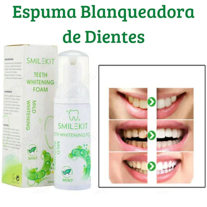 Espuma blanqueadora de dientes