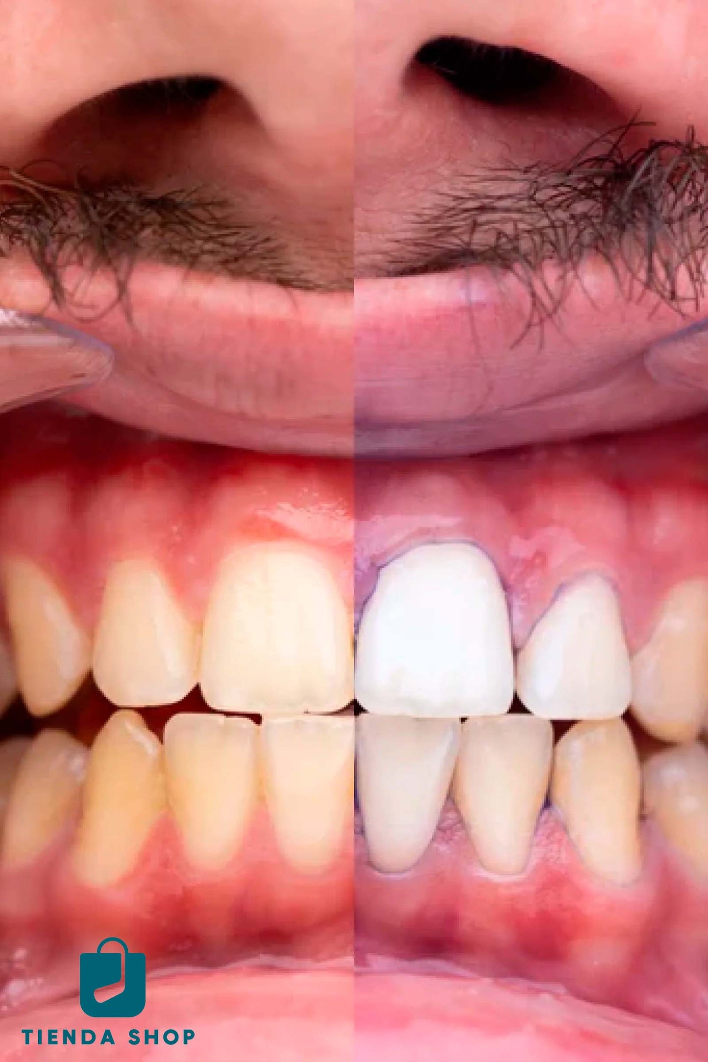 Crema dental blanqueadora morada