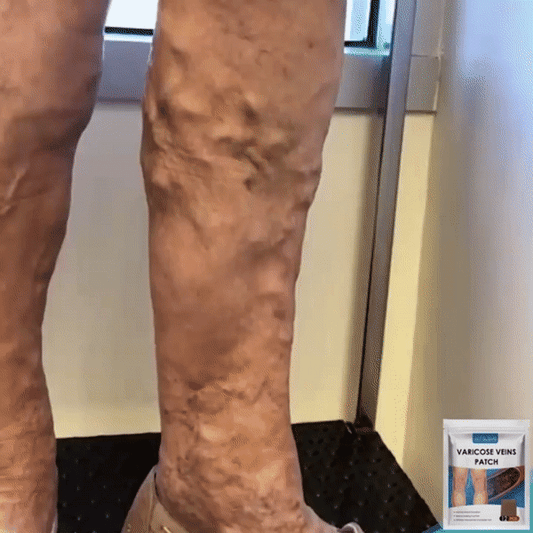 Parche Para Varices Royal Prestige
